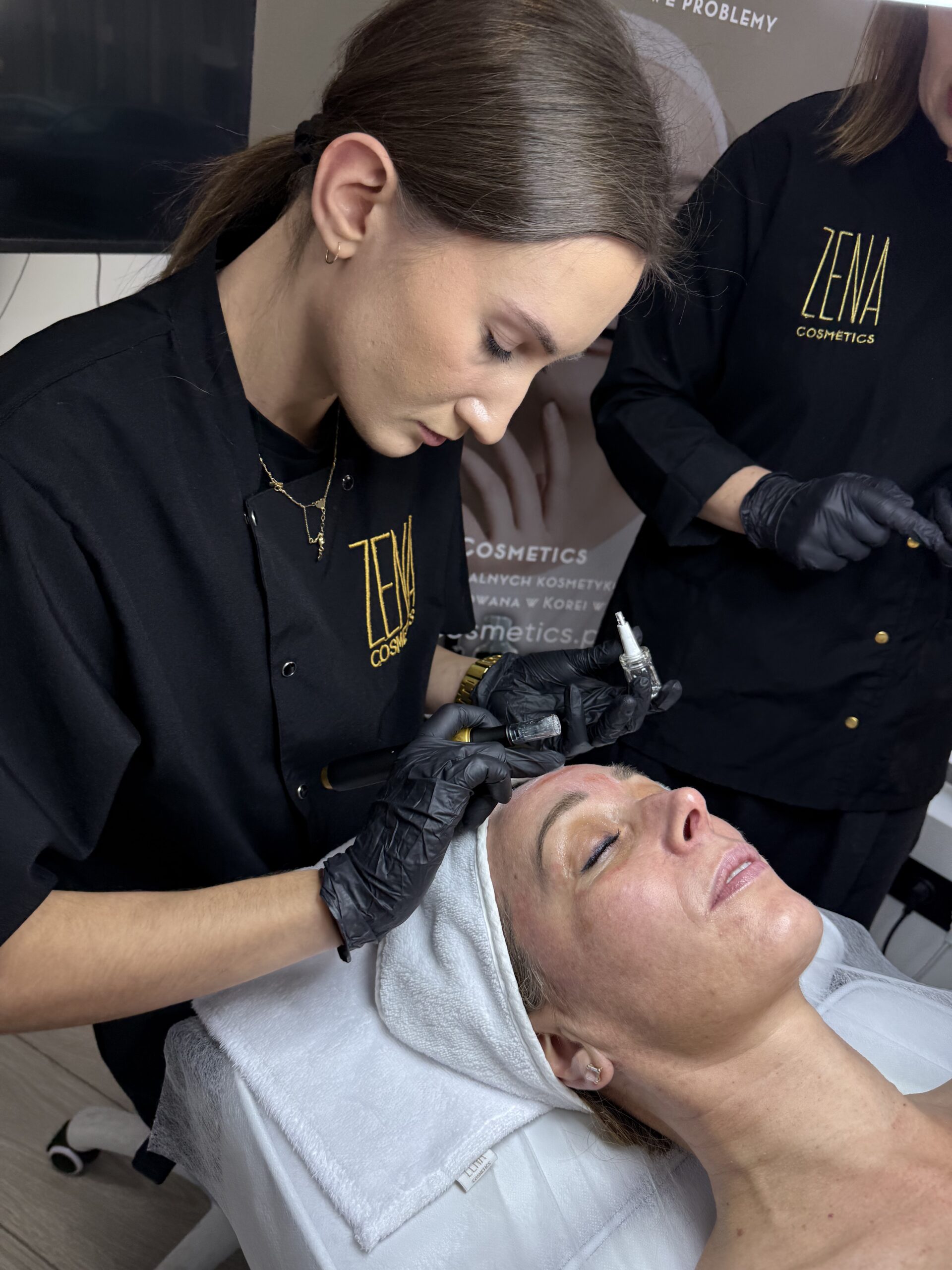 Mezoterapia mikroigłowa — zabieg ZENA